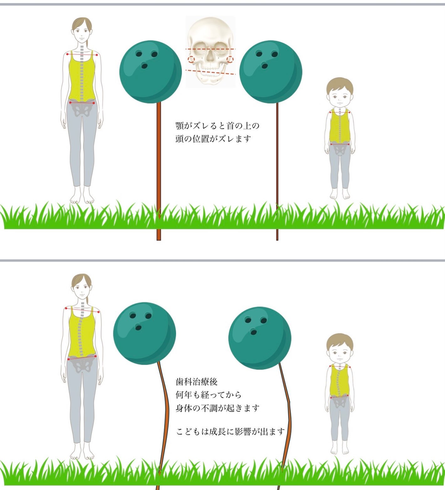 噛み合わせと体の歪み