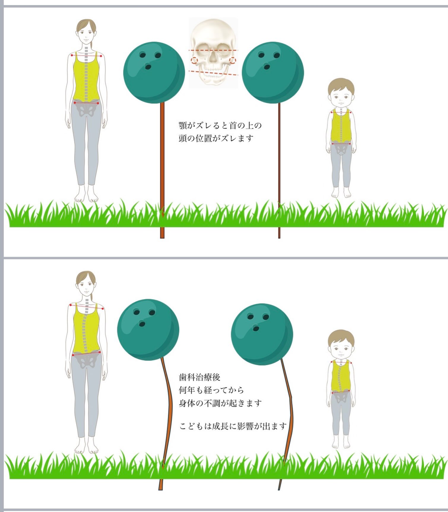 噛み合わせと体の歪み